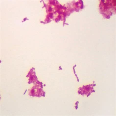 Salmonella (typhimurium, eberthella) Microscope Slides, w.m. | Carolina Biological Supply