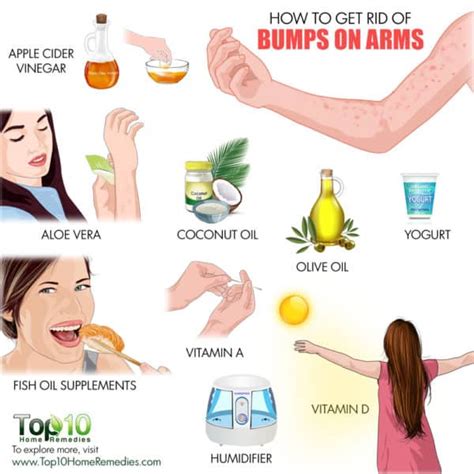 What Are Those Little Bumps On The Back Of Your Arms Skin Food | Images ...