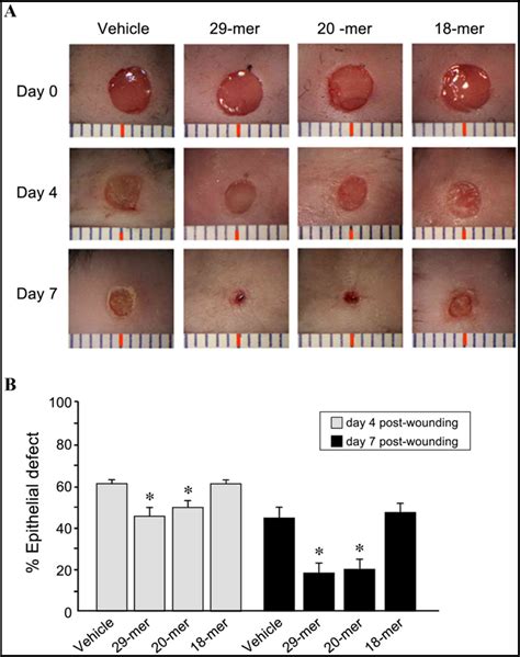 Pigment epithelium‑derived factor short peptides facilitate full‑thickness cutaneous wound ...