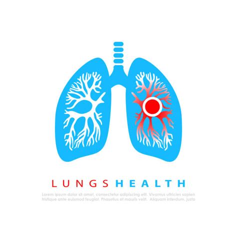 Copd Illustrations, Royalty-Free Vector Graphics & Clip Art - iStock