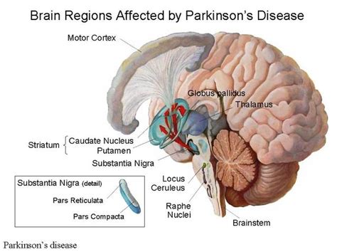 Parkinsons disease « Helpline