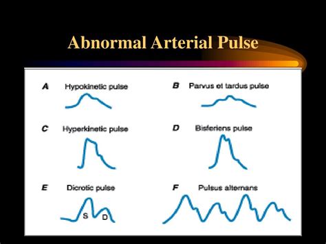 PPT - Book Reading-Heart Disease Braunwald PowerPoint Presentation, free download - ID:319342