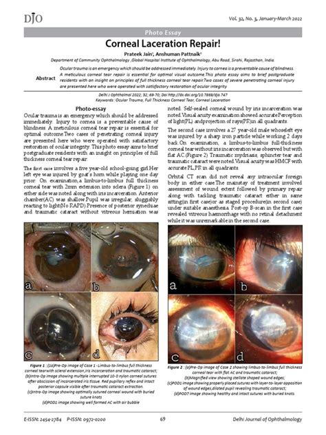 Corneal Laceration Repair | PDF | Cornea | Cataract