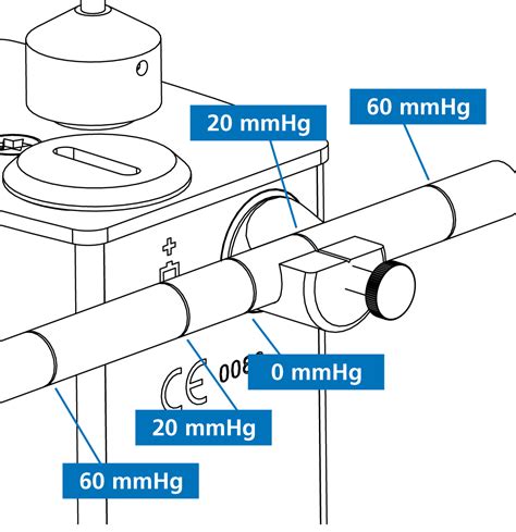 Goldmann tonometer calibration - Going for Goldmann