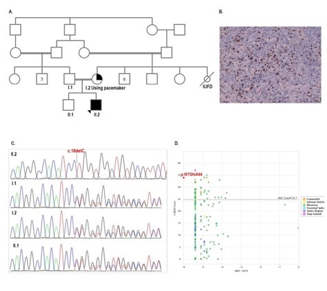 Pedigree of the patient (A). Epstein-Barr virus-encoded small RNA... | Download Scientific Diagram