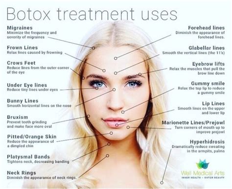 Pin by Laura Buchanan on Work Facebook page | Botox face, Botox, Botox ...