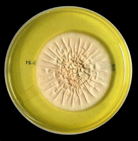 Fun With Microbiology (What's Buggin' You?): Acremonium species