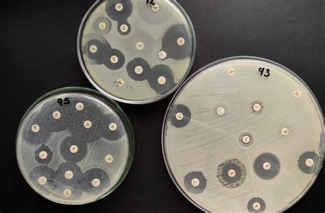 Staphylococcus aureus meticilino resistente MRSA | LABORATORIO ...