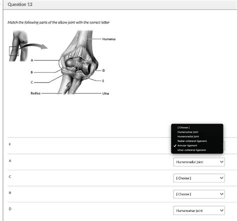 SOLVED: Match the following parts of the elbow joint with the correct letter: A. Humerus B. Ulna ...