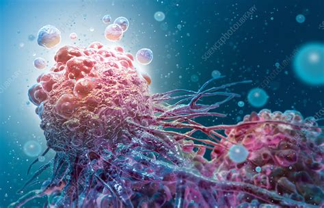 Cancer Cell Apoptosis - Stock Image - C030/7081 - Science Photo Library