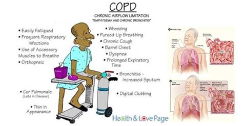 Respiratory Diagram | Quizlet