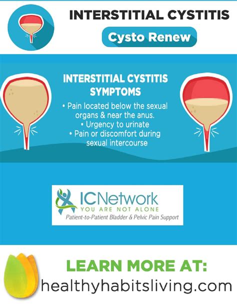 This Is What Makes Cysto Renew The Best Support For Interstitial Cystitis | Interstitial ...