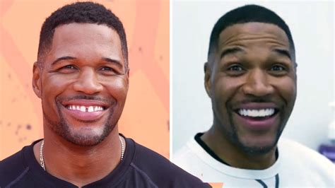 Michael Strahan Confirms That Closing the Gap in His Teeth Was an April ...