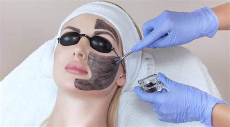 Carbon Laser Peel Facial - All You Need To Know