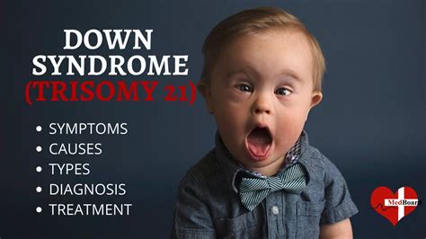 What is Down Syndrome (Trisomy 21)? Down syndrome (Trisomy 21) Made Easy - YouTube