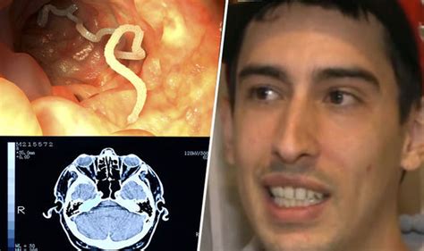 Man Has Tapeworm Removed From Brain! – OddYap Strange News & Curious ...