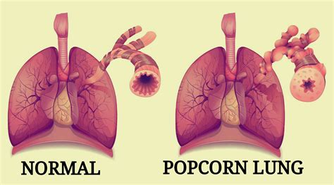 Which Vaping Liquids Contain Diacetyl? Should You be Worried? – Ecigopedia