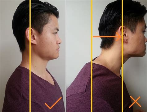 How To Fix Forward Head Posture - Posture Direct