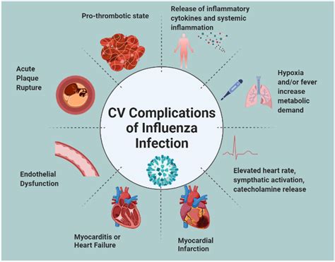 Cardiovascular (CV) complications associated with influenza infection | Download Scientific Diagram