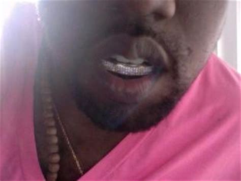 Kanye West replaces teeth with diamonds | news.com.au — Australia’s leading news site