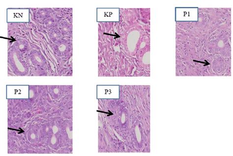 Gambar. 3. Sel Epitel Kelenjar Endometrium Keterangan :Tanda panah ...