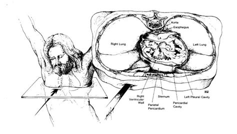 The Medical Side Of Yeshua Jesus's Crucifixion