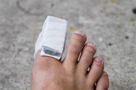 Ask the Foot Doc – Healing a Broken Toe: Hubert Lee, DPM: Podiatrist