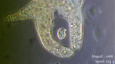 Amoeba eats paramecia ( Amoeba's lunch ) [ Amoeba Endocytosis ...