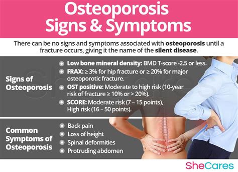 Signs and Symptoms of Osteoporosis