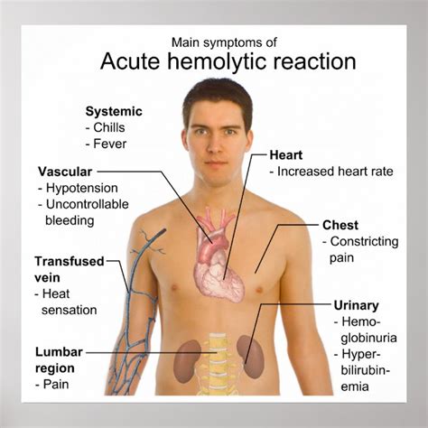 Symptoms of Acute Hemolytic Transfusion Reaction Poster | Zazzle.co.uk