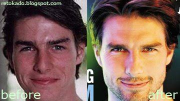 FASHION EXTRA: Tom Cruise Nose Job