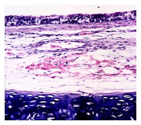 Histopathological changes in the trachea from different experimental ...