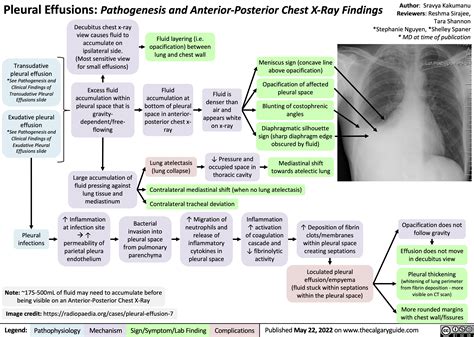 pleural effusion | Calgary Guide