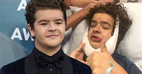 How Gaten Matarazzo Fixed His Teeth And The Truth About His Condition