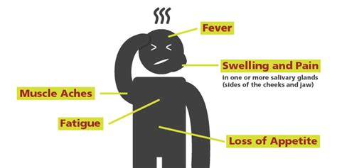 studentHUB News | Toronto Public Health Mumps Alert