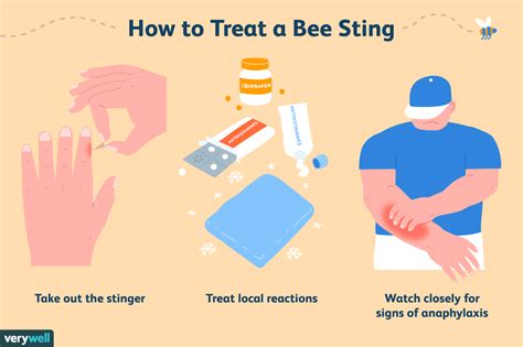 Bee Sting: What Treatments and Remedies Actually Work