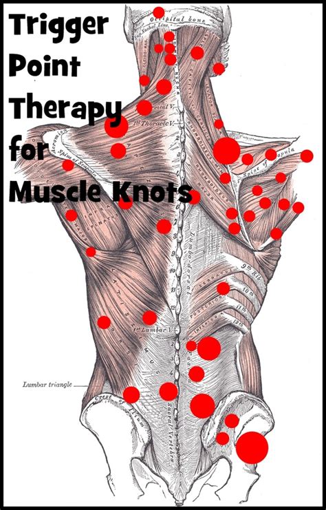 Effective Trigger Point Therapy for Muscle Knots | RemedyGrove