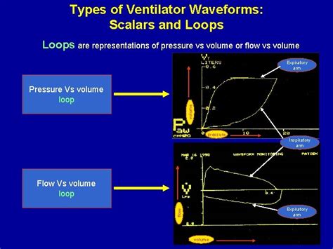 Ventilator Waveforms Basic Interpretation and Analysis Vivek Iyer