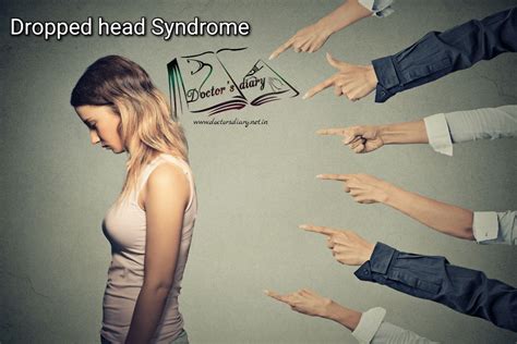 68. Dropped Head Syndrome - Doctor's Diary