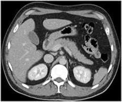 Getting Ready for Your Abdominal CT Scan | Sansum Clinic