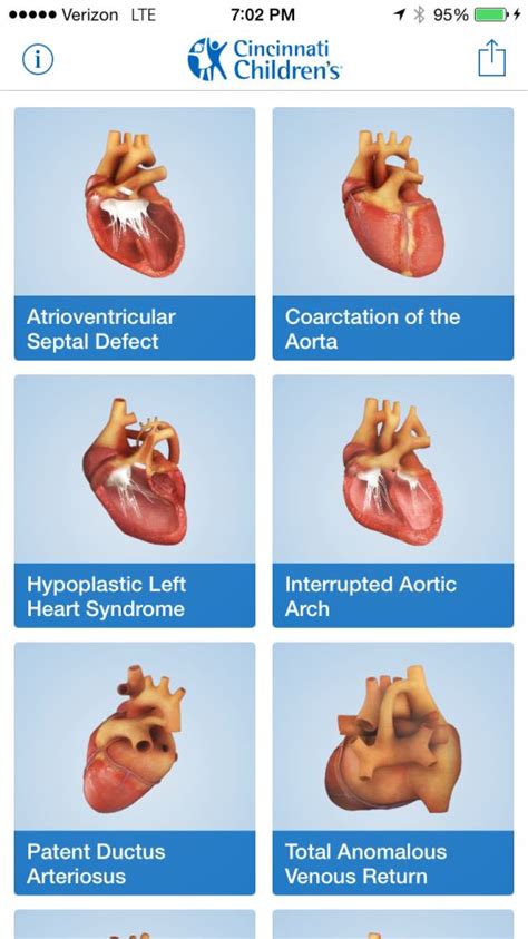 Congenital Heart Defects Types