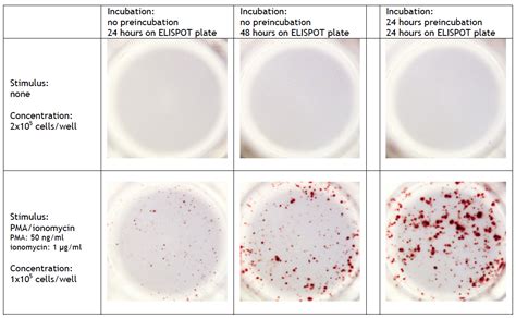 Frequently asked questions ELISPOT and FluoroSpot assay | U-CyTech