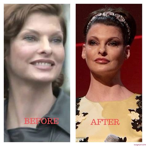 Linda Evangelista Plastic Surgery Photos [Before & After] ⋆ Surgery4