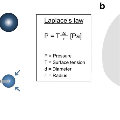 Laplace’s law and catheter scheme. Following Laplace’s law, after ...