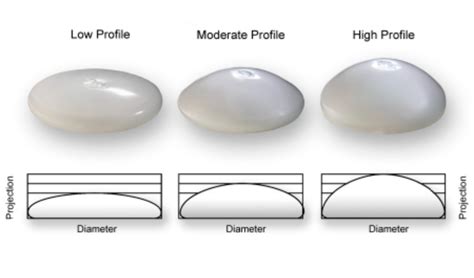 Breast Augmentation Sizes Chart