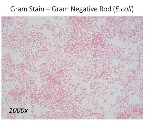 3-7: The Gram Stain, 3-10: Endospore Stain, 3-8: Acid Fast Stain, 3-9: Capsule Stain Flashcards ...