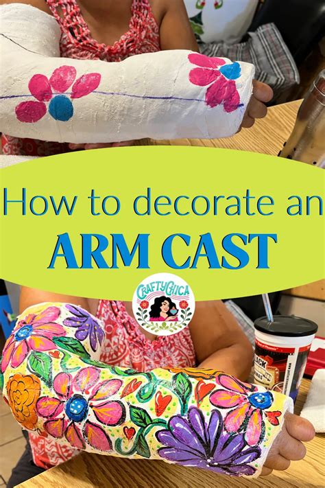 How to paint and decorate an arm cast - Crafty Chica