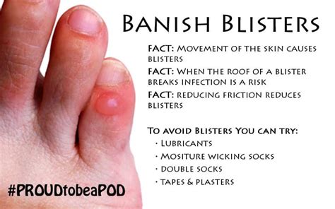 Blisters are Painful! - Davenport House Clinic