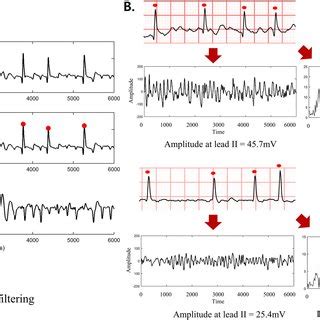 (PDF) Early differentiation of long-standing persistent atrial fibrillation using the ...