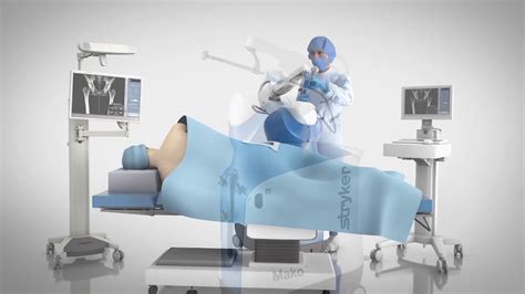 Mako robot for hip replacement - YouTube